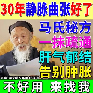 静脉曲张冷敷凝胶蚯蚓腿肿胀青筋凸起精索效特腿部用专膏官方正品