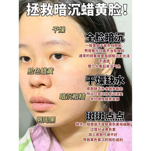 3.5现货【数量加购5到手19.9】Face-saving美bai祛ban精华油