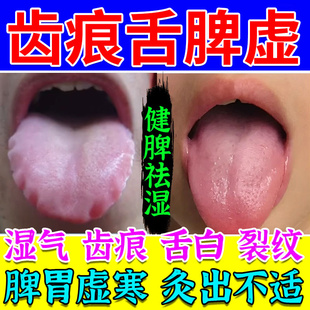 舌头肥大有齿痕舌白调理去脾虚湿气重裂纹脾胃虚弱肝火盛肚脐贴HT