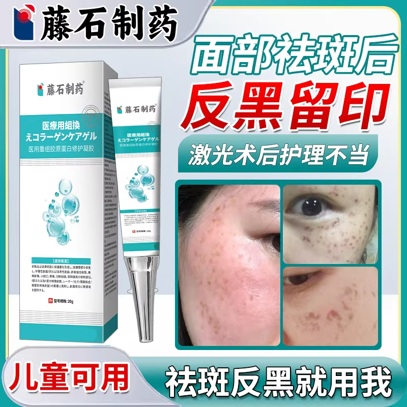 激光祛斑后反黑修复脸上黑斑去疤印去黑色素沉淀分解医用型除膏VQ
