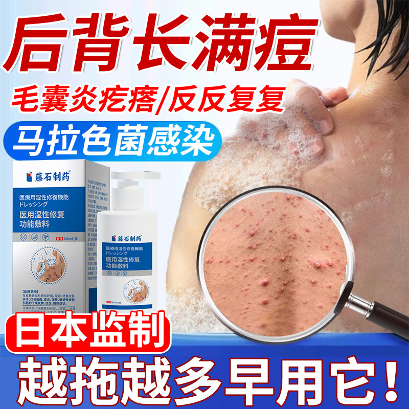 【藤石制药】前胸后背长痘痘