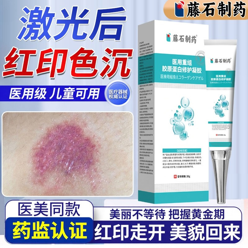 淡化点阵激光点痣后去红印修复凝胶术后祛痣膏疤痕贴去斑液神器HT