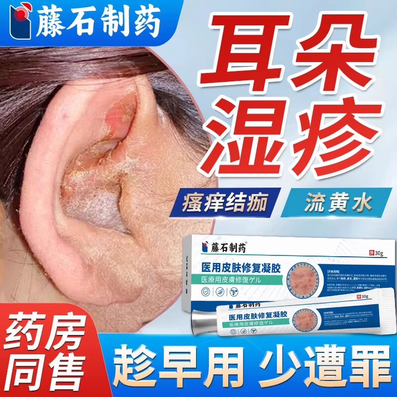 耳朵湿疹专用外耳道炎瘙痒流脓除湿去止痒根真菌感染药房同售膏WQ