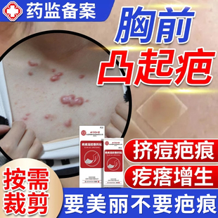 胸口疤痕疙瘩增生凸起硬肉祛疤贴胸前去除瘢痕除疤膏去疤隐形防WQ