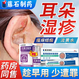 耳朵湿疹专用外耳道炎瘙痒流脓除湿去止痒根真菌感染药房同售膏WQ