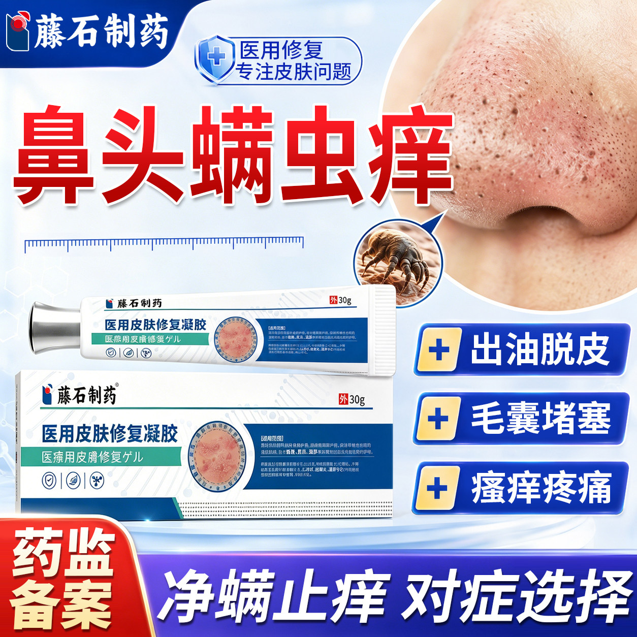 鼻头去螨虫专用脸部面部鼻子除螨皮肤叮咬消肿止痒用药房同售膏WQ