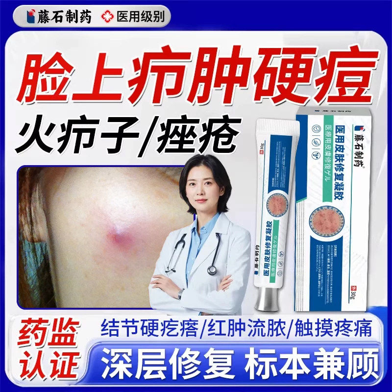 脸上疖肿结节硬块痘痘起硬疙瘩红肿毛囊炎痤疮火疖子囊肿脓包型WQ