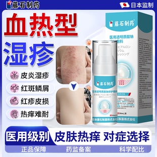 血热性湿疹皮肤痒止痒去热毒湿疹根皮肤一热就痒专用除湿止痒膏HT