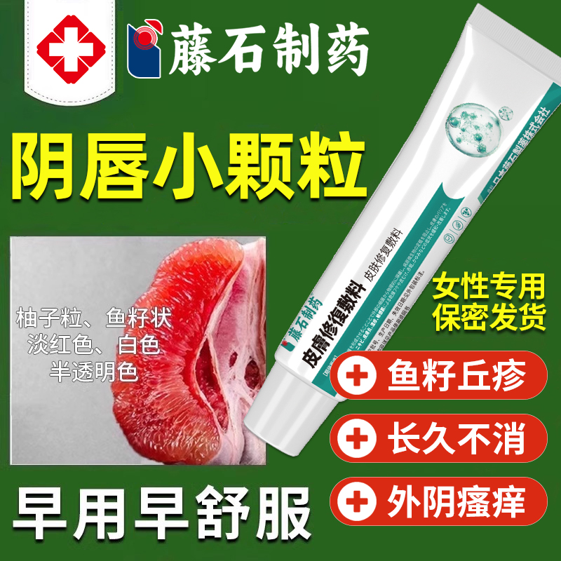 假性湿疣外阴小颗粒瘙痒专用软膏