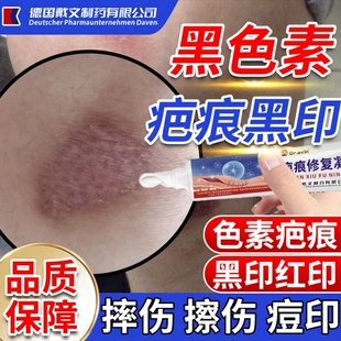 去疤印去黑色素沉淀去除淡化疤痕擦伤摔伤油烫伤黑印修复除疤膏YZ