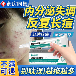 内分泌调理失调下巴脸颊两边反复长痘结节祛硬块脓包药房同售膏VQ