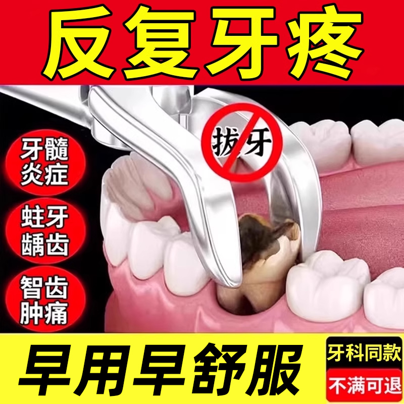 牙髓炎牙疼喷雾剂牙痛消炎牙龈肿痛牙膏杀死牙神经痛可搭配药水TU-封面