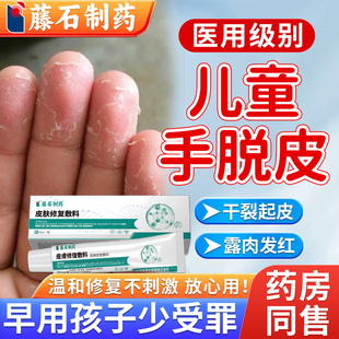 儿童手指脱皮干裂真菌感染专用可搭治疗手起皮的药膏青少年小孩WQ