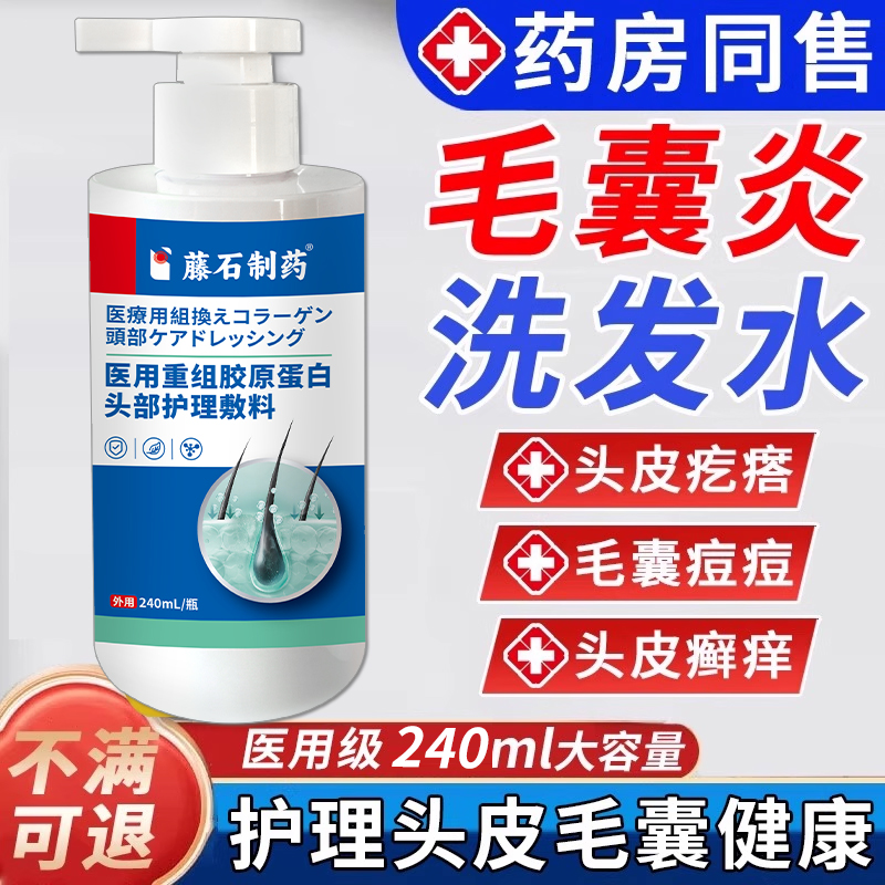 头皮毛囊炎洗发水头痒头疙瘩