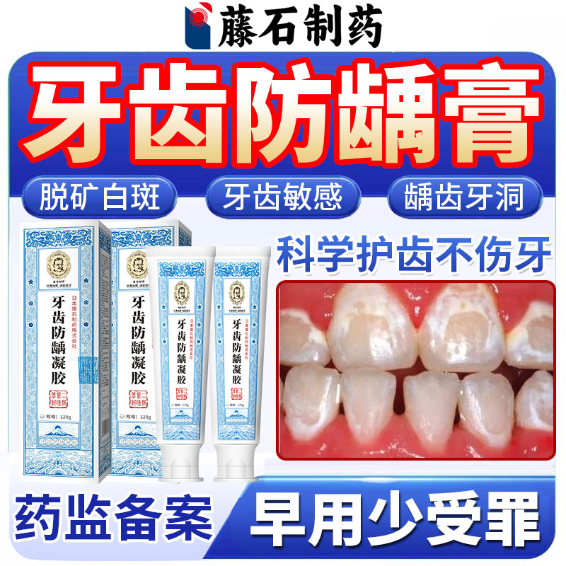 【牙齿防龋膏】牙齿白斑脱矿敏感