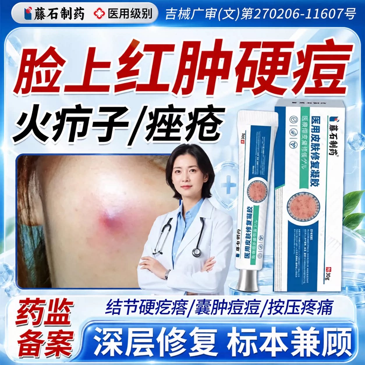 脸上疖肿红肿型痘痘结节硬块痘上火祛疙瘩囊肿型火疖子药房同款WQ