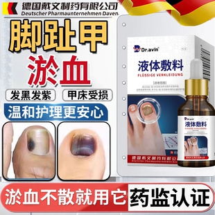 脚趾甲被砸指甲被夹压受损瘀血发黑甲床受伤甲下淤血发紫生长液HT