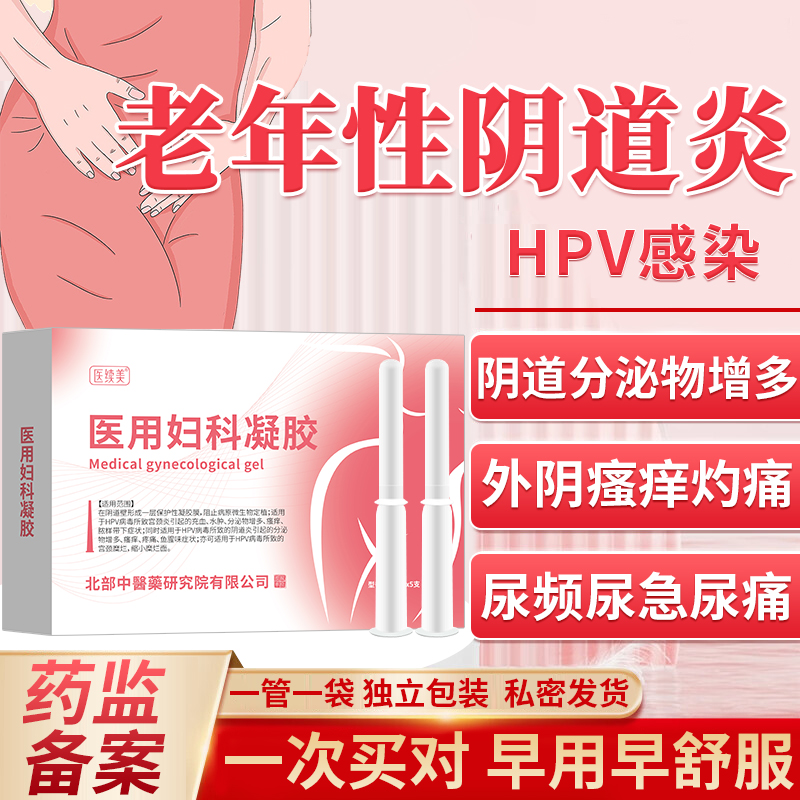 老年性阴道炎瘙痒流黄色分泌物