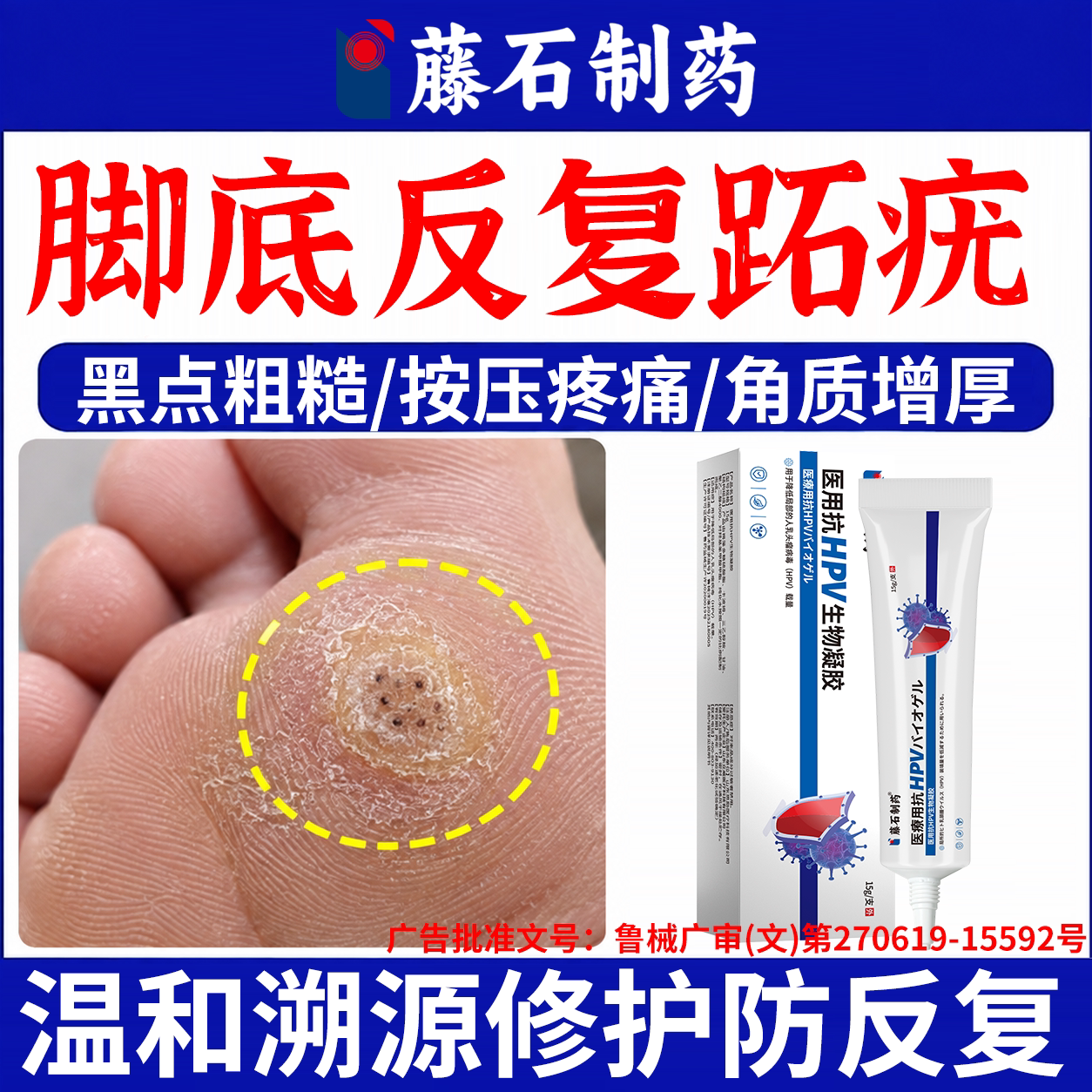 跖疣专用去除药房膏去病毒疣根连根拔根脚底除祛除蚩尤净拓趾疣YS