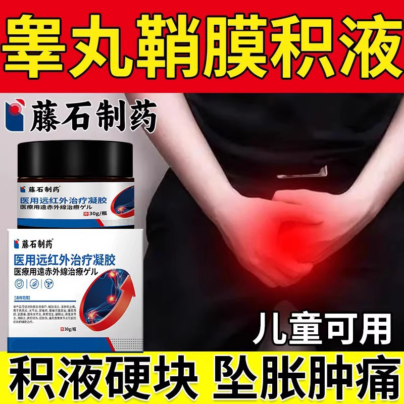 睾丸鞘膜积液疼痛下垂囊肿附睾炎硬结阴囊精索静脉曲张药房同售VQ