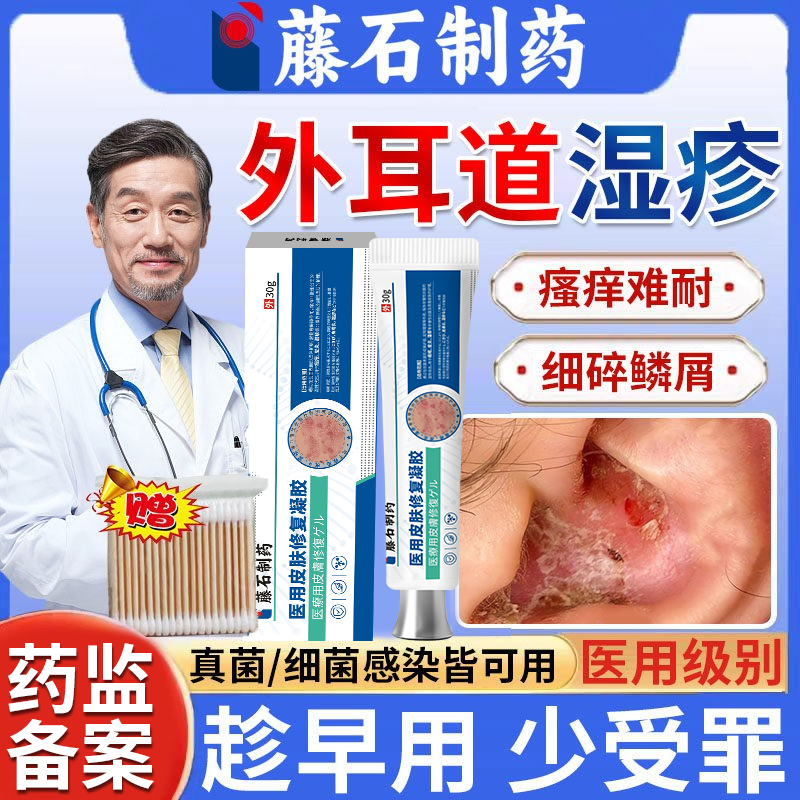 外耳道炎耳道湿疹耳朵痒真菌感染止痒去专用根真菌性药房同售膏HT