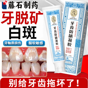 牙釉质损伤牙齿脱矿修复修补液含氟涂氟儿童有白斑牙膏敏感酸痛VQ