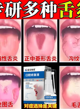 舌炎舌头炎舌康灵喷雾舌头上火裂纹溃疡疙瘩疼口舌生疮药房同售VQ