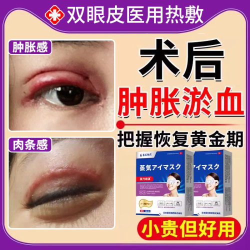 双眼皮术后消肿蒸汽眼罩医用款