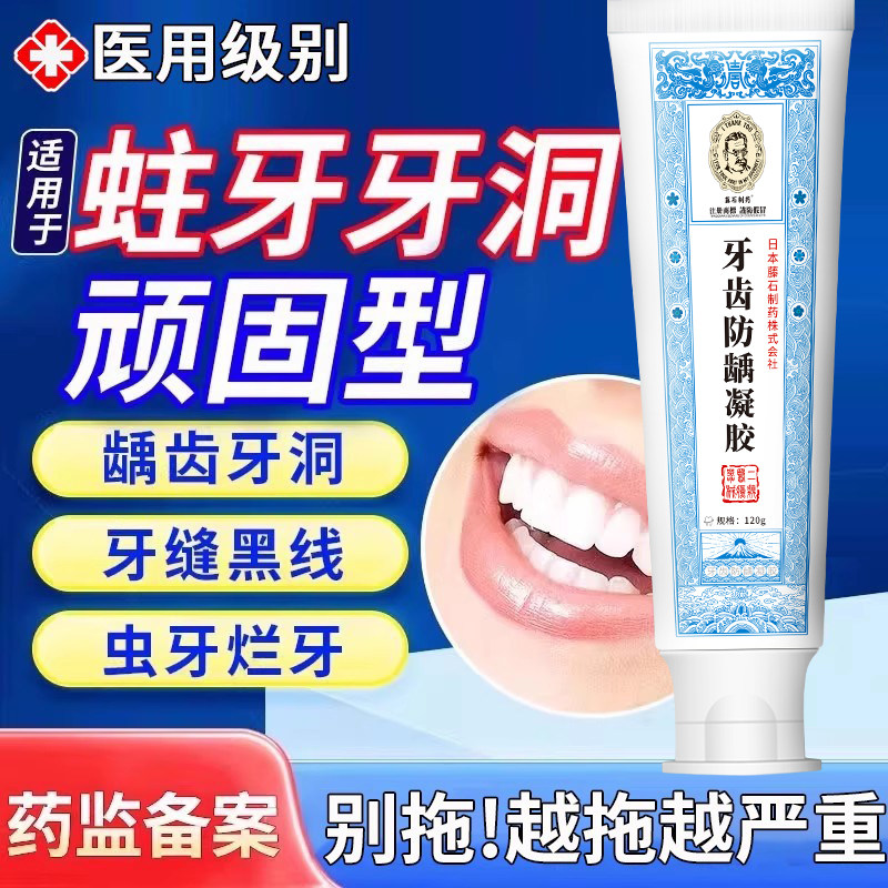 防蛀抗敏含氟成人防蛀牙龋齿修牙黑线黑斑去除复专用高氟搭牙膏VQ