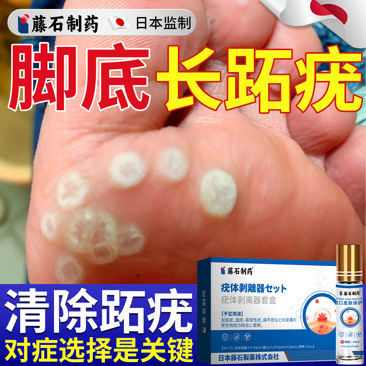 日本监制--脚底跖疣膏--无痛脱落