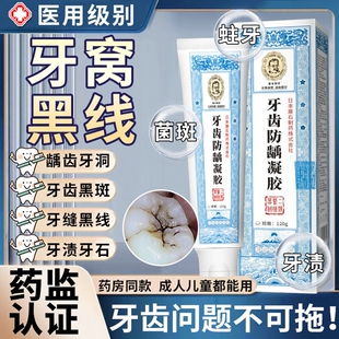 牙菌斑牙膏牙齿牙黑线去除补牙缝蛀牙祛除龋齿专用缝隙黑牙黑斑YZ