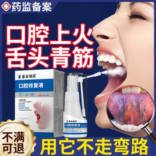 舌下青筋又黑又粗舌头底有淤血黑紫口腔炎血管堵塞溶栓液喷剂YZ