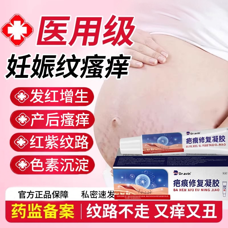 产后妊辰纹修复霜疤痕膏医用凝胶消除祛去妊娠纹痒止痒药房同款YZ