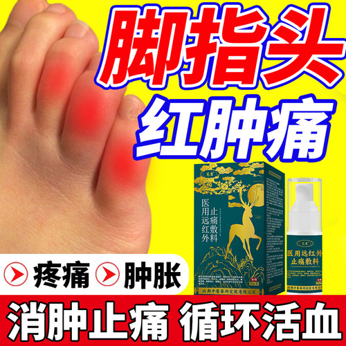 脚趾肿痛红肿胀痛喷剂