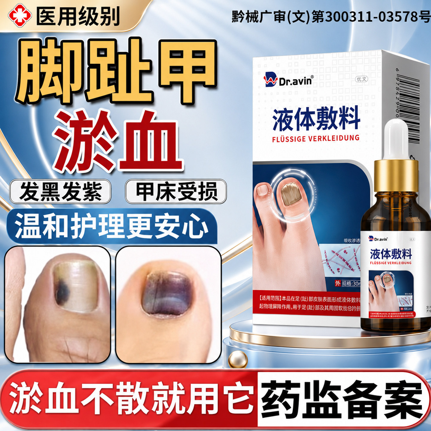 【医用级别】指甲趾甲被砸淤血图片