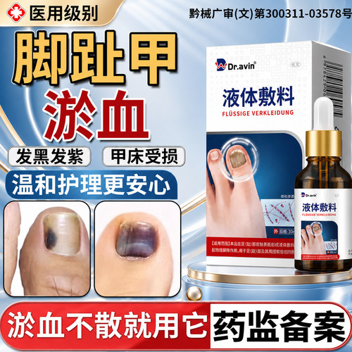 【医用级别】指甲趾甲被砸淤血