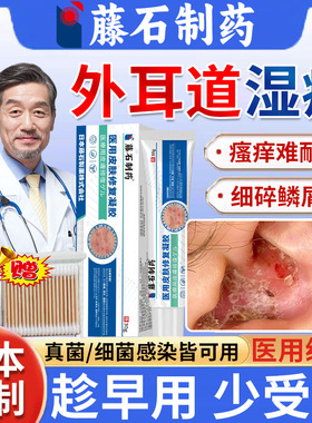 外耳道炎湿疹耳朵痒真菌感染止痒去领专用和根真菌性药房同售膏HT