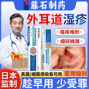 外耳道炎湿疹耳朵痒真菌感染止痒去领专用和根真菌性药房同售膏HT