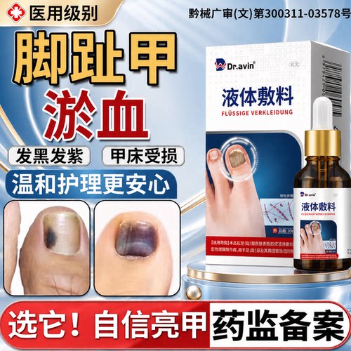 【医用级别】指甲趾甲被砸淤血