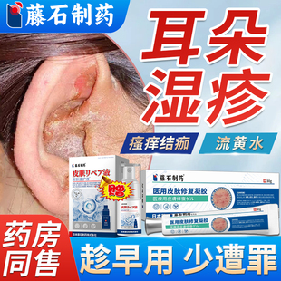 耳朵湿疹专用外耳道炎瘙痒流脓除湿去止痒根真菌感染药房同售膏WQ