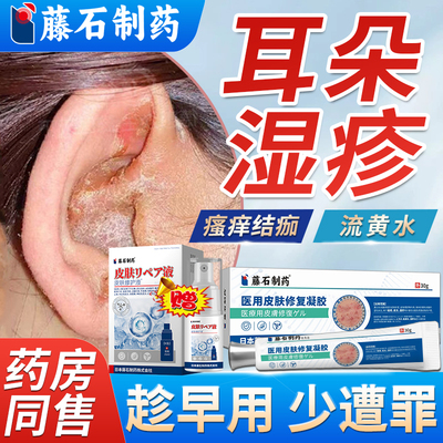藤石制药耳朵湿疹瘙痒皮肤修复
