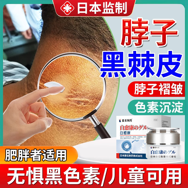 脖子黑黑的去除黑棘皮症病儿童去黑色素沉淀膏也可搭配药膏用tu