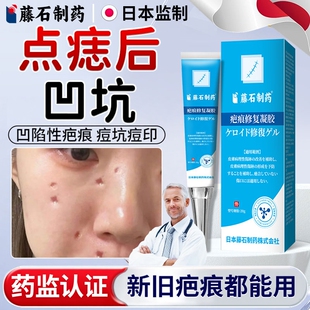 点痣后凹陷性疤痕修复除疤膏祛疤抓伤红印去黑印色素沉淀水痘坑HT