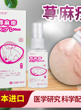 日本进口配方专治顽固性荨麻疹过敏止痒碱性急慢丘疹皮肤骚痒喷剂