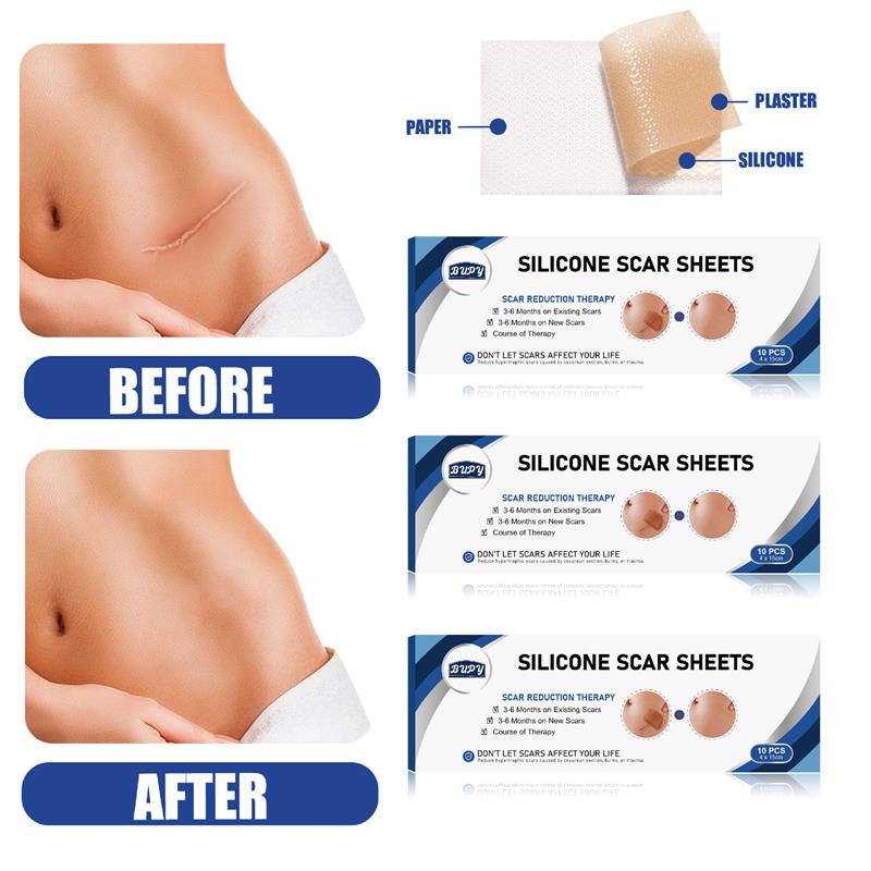 Scars from sticky scars and silicone gel fixes C-section inv