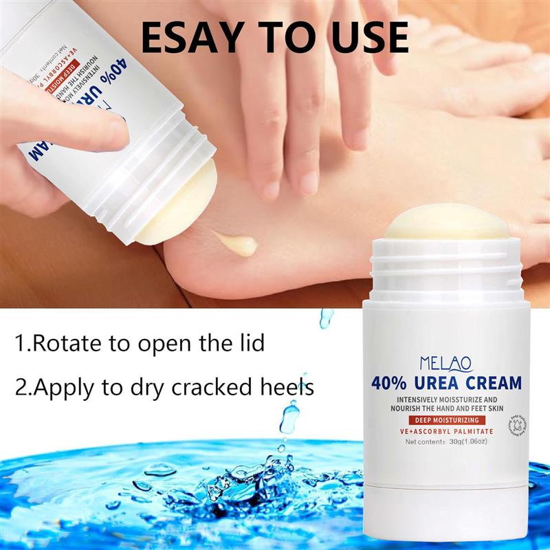 Customized urea cream-care rods on the soles of the soles an