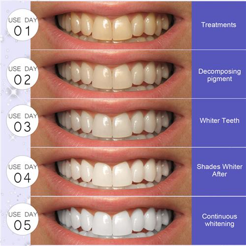 Five-D toothpaste to show off the white tooth-clip, tooth-cr