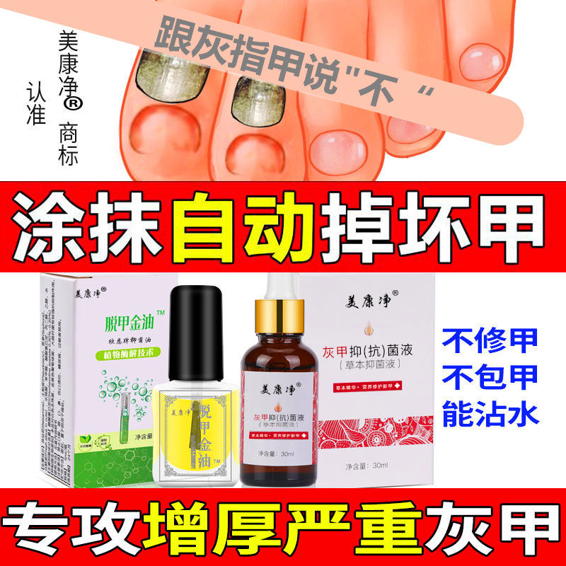 【多年顽固灰甲】正品美康净灰甲抑菌液套装美康净脱甲金油灰甲净
