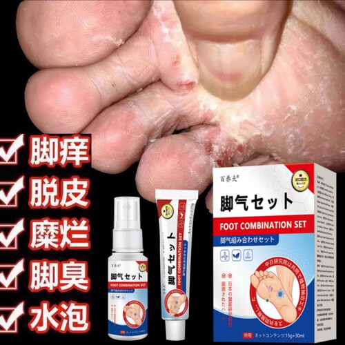 夏天皮肤干燥止痒脚气膏腿痒小腿身上瘙痒全身痒外用抑菌喷雾夏季