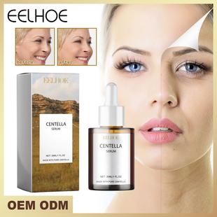 EELHOE Centella Asiatica Essence Liquid Moisturizes and Impr